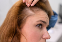 Tips for Combining Scalp Growth Factors with Daily Hair Maintenance Protocols