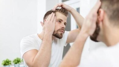 Men's Hair Loss in Florida