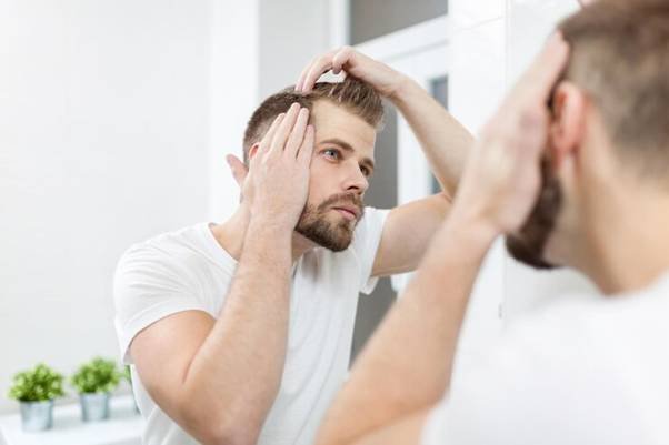 Men's Hair Loss in Florida